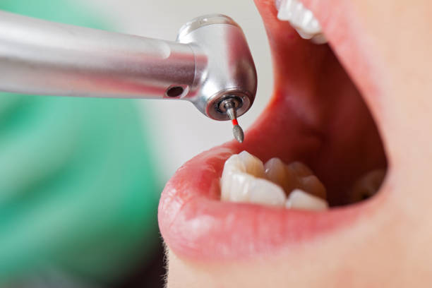 Best Emergency Dental Care for Broken or Chipped Teeth in Red Rock, AZ